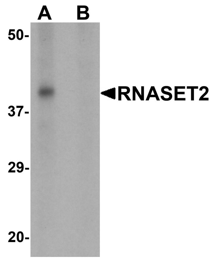 Western blot analysis of RNASET2 in SW480 cell lysate with RNASET2 antibody at 1 ug/ml in (A) the absence and (B) the presence of blocking peptide.