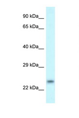 RND1 antibody LS-C145655 Western blot of 1 Cell lysate. Antibody concentration 1 ug/ml.