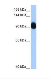 Transfected 293T cell lysate. Antibody concentration: 0.25 ug/ml. Gel concentration: 8%.