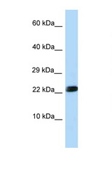 RNF11 antibody LS-C146090 Western blot of Rat Liver lysate. Antibody concentration 1 ug/ml.