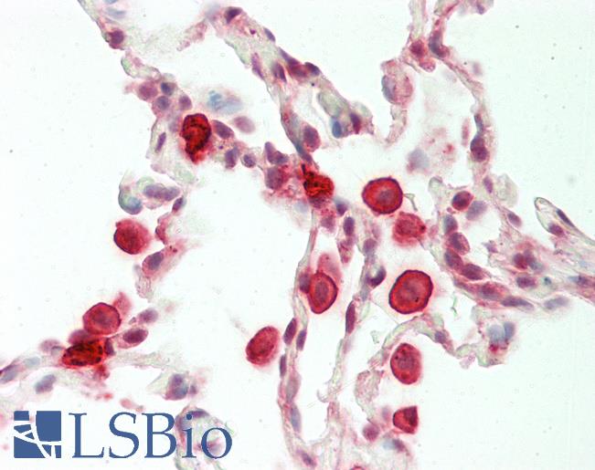 Human Lung: Formalin-Fixed, Paraffin-Embedded (FFPE)