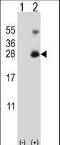 Western blot of RNF11 (arrow) using rabbit polyclonal RNF11 Antibody. 293 cell lysates (2 ug/lane) either nontransfected (Lane 1) or transiently transfected (Lane 2) with the RNF11 gene.