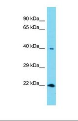 Western blot of Human Thyroid Tumor. RNF113A antibody dilution 1.0 ug/ml.