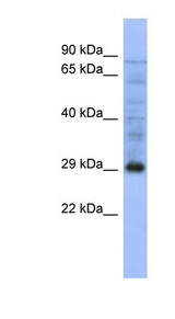 PSMA5 / ZETA antibody western blot of Human Jurkat lysate.