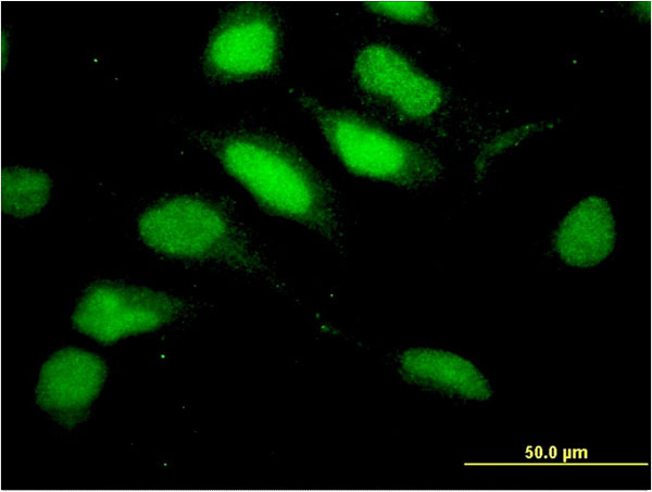 Immunofluorescence of monoclonal antibody to RNF113A on HeLa cell . [antibody concentration 10 ug/ml]