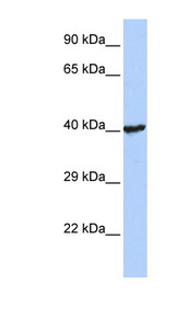 RNF113B antibody LS-C101523 Western blot of Jurkat lysate.