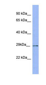 PSMA5 / ZETA antibody LS-C107576 Western blot of Fetal Thymus lysate.