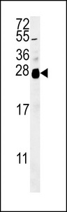 ZNF313 Antibody western blot of A2058 cell line lysates (35 ug/lane). The ZNF313 antibody detected the ZNF313 protein (arrow).