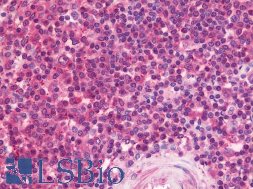 Anti-RNF114 / ZNF313 antibody IHC staining of human spleen. Immunohistochemistry of formalin-fixed, paraffin-embedded tissue after heat-induced antigen retrieval. Antibody LS-B10832 concentration 7.5 ug/ml.