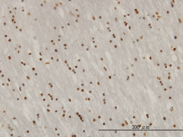 Immunoperoxidase of monoclonal antibody to ZNF313 on formalin-fixed paraffin-embedded human lateral ventricle wall (antibody concentration 3 ug/ml).
