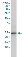 ZNF313 monoclonal antibody (M01), clone 4G3-1A10 Western blot of ZNF313 expression in HepG2.