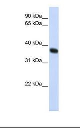 HepG2 cell lysate. Antibody concentration: 1.0 ug/ml. Gel concentration: 12%.