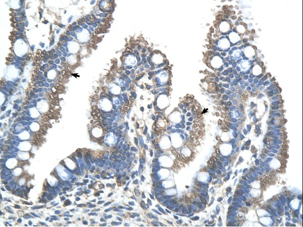 RNF121 antibody LS-C31986 was used in IHC to stain formalin-fixed, paraffin-embedded human intestine.