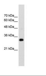 Jurkat Cell Lysate