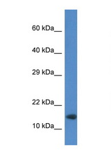 RNF122 antibody LS-C135127 Western blot of Mouse Heart lysate. Antibody concentration 1 ug/ml.
