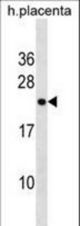 RNF122 Antibody western blot of human placenta tissue lysates (35 ug/lane). The RNF122 antibody detected the RNF122 protein (arrow).