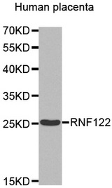 Western blot analysis of extracts of Human placenta cell line, using RNF122 antibody.
