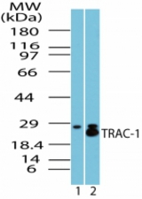 Western blot of TRAC-1 in spleen lysate. Lane 1 shows pre-immune sera and lane 2 shows antibody tested on human spleen lysate at 1:1000 dilution.