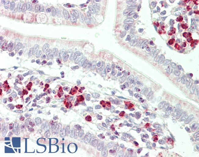 Anti-RNF125 antibody IHC staining of human small intestine. Immunohistochemistry of formalin-fixed, paraffin-embedded tissue after heat-induced antigen retrieval. Antibody LS-B11326 concentration 5 ug/ml.