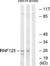 Western blot of extracts from K562/HT-29 cells, using RNF125 Antibody. The lane on the right is treated with the synthesized peptide.