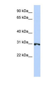 RNF126 antibody LS-C102009 Western blot of Jurkat lysate.