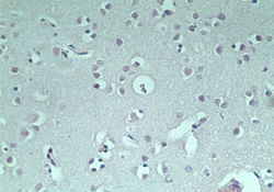 IHC of normal human brain using control (rabbit Ig) at 5 ug/ml.