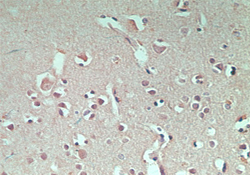 IHC of normal human brain using antibody (GRAIL) at 5 ug/ml.