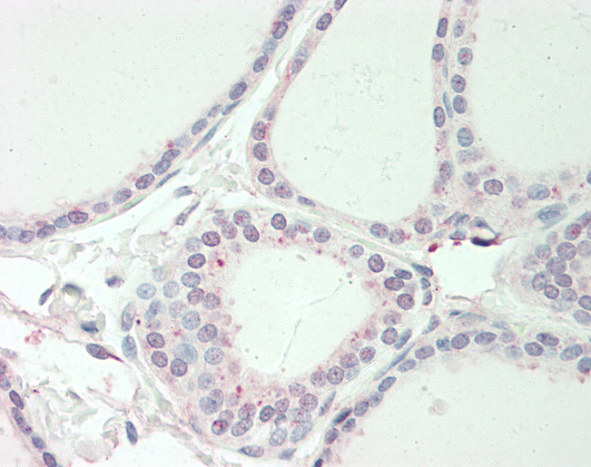 Human Thyroid: Formalin-Fixed, Paraffin-Embedded (FFPE)