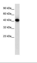 Jurkat Cell Lysate