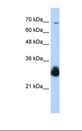 Transfected 293T cell lysate. Antibody concentration: 0.25 ug/ml. Gel concentration: 12%.