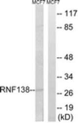 Western blot of extracts from MCF-7 cells, using RNF138 Antibody. The lane on the right is treated with the synthesized peptide.