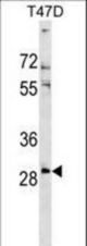 RNF138 Antibody western blot of T47D cell line lysates (35 ug/lane). The RNF138 antibody detected the RNF138 protein (arrow).