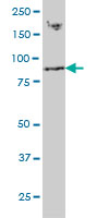 RNF139 monoclonal antibody (M01), clone 3D10 Western blot of RNF139 expression in HepG2.