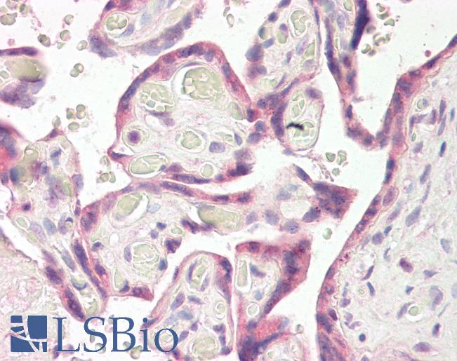 Anti-RNF139 / TRC8 antibody IHC of human placenta. Immunohistochemistry of formalin-fixed, paraffin-embedded tissue after heat-induced antigen retrieval. Antibody LS-B8293 dilution 3.75 ug/ml.