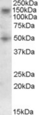 RNF139 antibody (0.5 ug/ml) staining of Human Skeletal muscle lysate (35 ug protein/ml in RIPA buffer). Primary incubation was 1 hour. Detected by chemiluminescence.