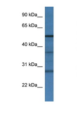 RNF14 antibody LS-C134969 Western blot of Rat Liver lysate. Antibody concentration 1 ug/ml.