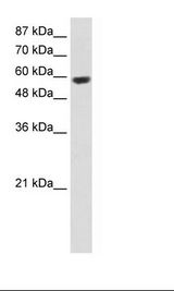 Jurkat Cell Lysate