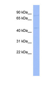 RNF14 antibody LS-C107497 Western blot of COLO205 cell lysate.