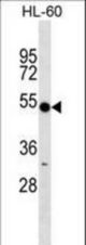 RNF14 Antibody western blot of HL-60 cell line lysates (35 ug/lane). The RNF14 antibody detected the RNF14 protein (arrow).