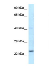 RNF141 antibody LS-C145538 Western blot of Mouse Kidney lysate. Antibody concentration 1 ug/ml.