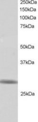 Antibody staining (1 ug/ml) of Human Testis lysate (RIPA buffer, 30 ug total protein per lane). Primary incubated for 1 hour. Detected by Western blot of chemiluminescence.