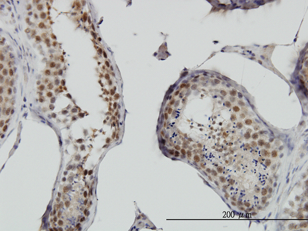 Immunoperoxidase of monoclonal antibody to RNF141 on formalin-fixed paraffin-embedded human testis. [antibody concentration 0.3 ug/ml]