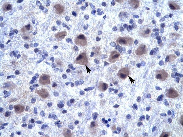 RNF141 antibody LS-C29840 was used in IHC to stain formalin-fixed, paraffin-embedded human brain.