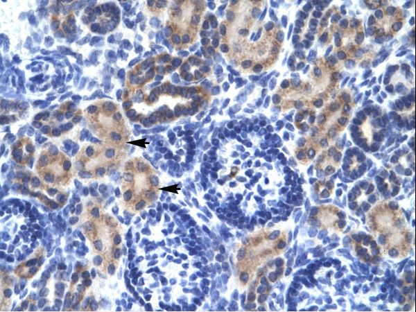 RNF141 antibody LS-C29840 was used in IHC to stain formalin-fixed, paraffin-embedded human kidney.