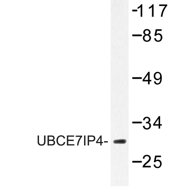 Western blot of UBCE7IP4 (R184) pAb in extracts from COLO cells.