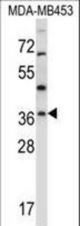 RNF144A Antibody western blot of MDA-MB453 cell line lysates (35 ug/lane). The RNF144A antibody detected the RNF144A protein (arrow).