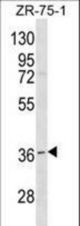 RNF144B Antibody western blot of ZR-75-1 cell line lysates (35 ug/lane). The RNF144B antibody detected the RNF144B protein (arrow).