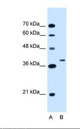 Lane A: Marker. Lane B: HepG2 cell lysate. Antibody concentration: 1.25 ug/ml. Gel concentration: 12%.
