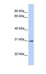 Fetal brain lysate. Antibody concentration: 1.0 ug/ml. Gel concentration: 12%.