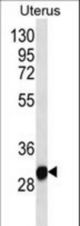 RNF148 Antibody western blot of human normal Uterus tissue lysates (35 ug/lane). The RNF148 antibody detected the RNF148 protein (arrow).